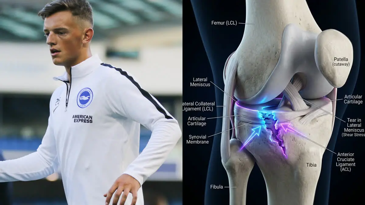 Ben White's Severe Knee Injury: A Biomechanical Analysis of Lateral Meniscus Shear and Joint Longevity