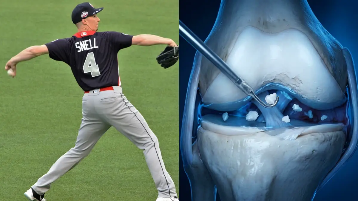 Blake Snell's NanoNeedle Elbow Surgery: The Future of Minimally Invasive Sports Medicine