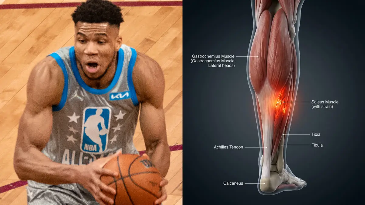 Giannis Antetokounmpo's Soleus Calf Strain: Deep Muscle Biomechanics of Basketball Acceleration, Myotendinous Junction Traumas, and Ayurvedic Rakta-Mamsa Recovery