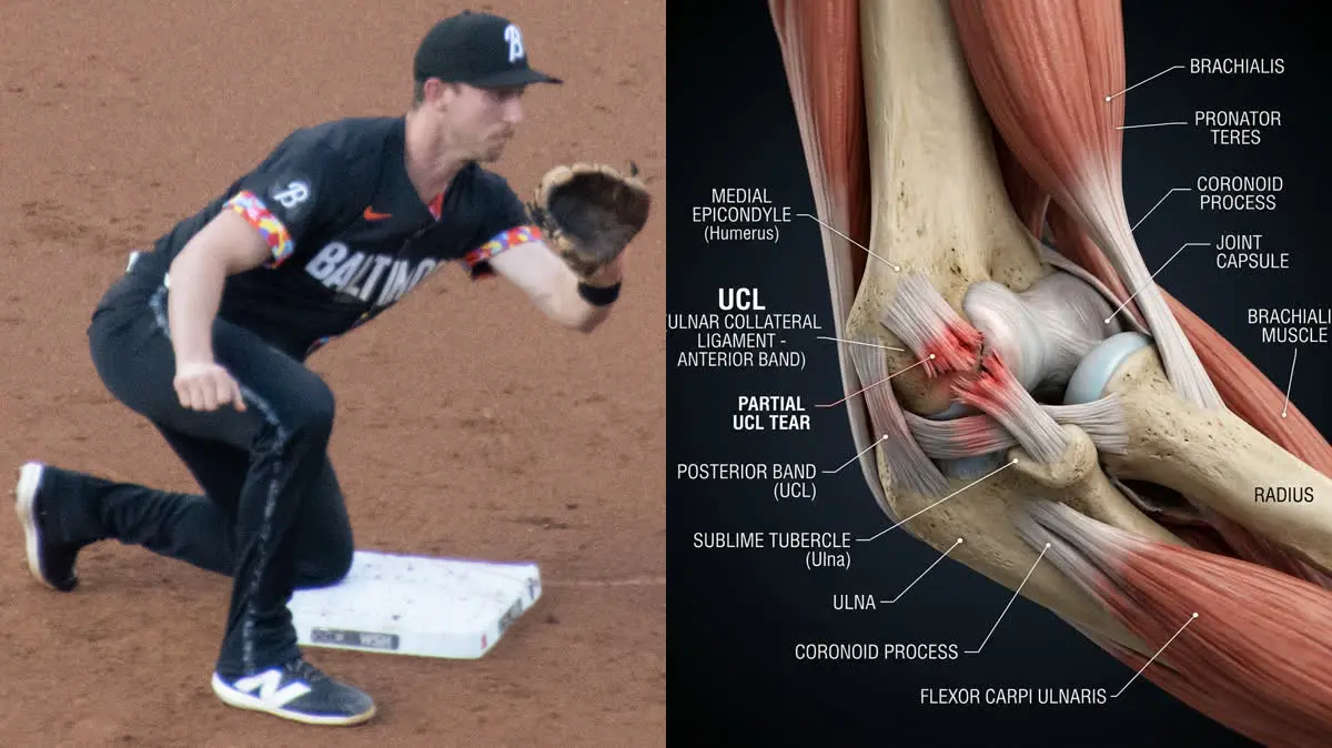 Jordan Westburg's Tommy John Surgery: Biomechanical Mechanics of UCL Tears and Elbow Rehabilitation