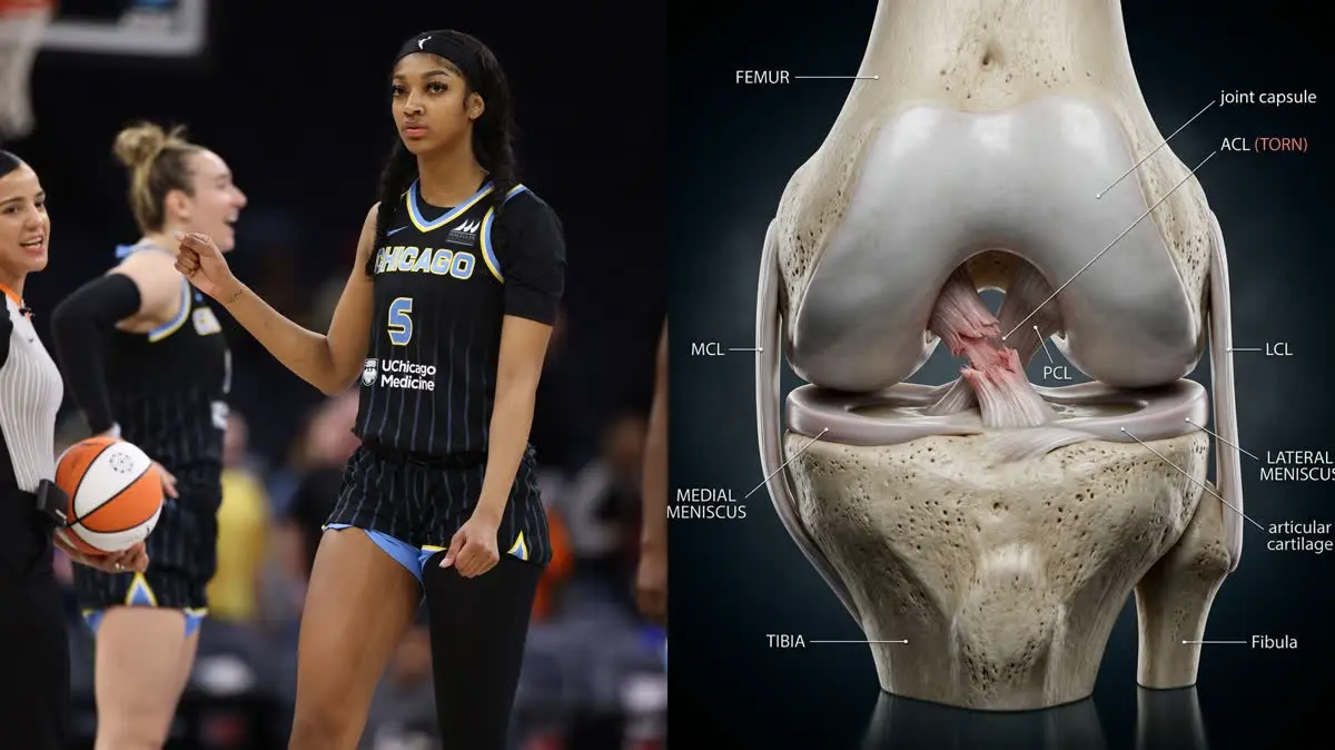 Rickea Jackson's WNBA Season-Ending ACL Tear: Biomechanics of Non-Contact Knee Injuries and Reconstructive Recovery