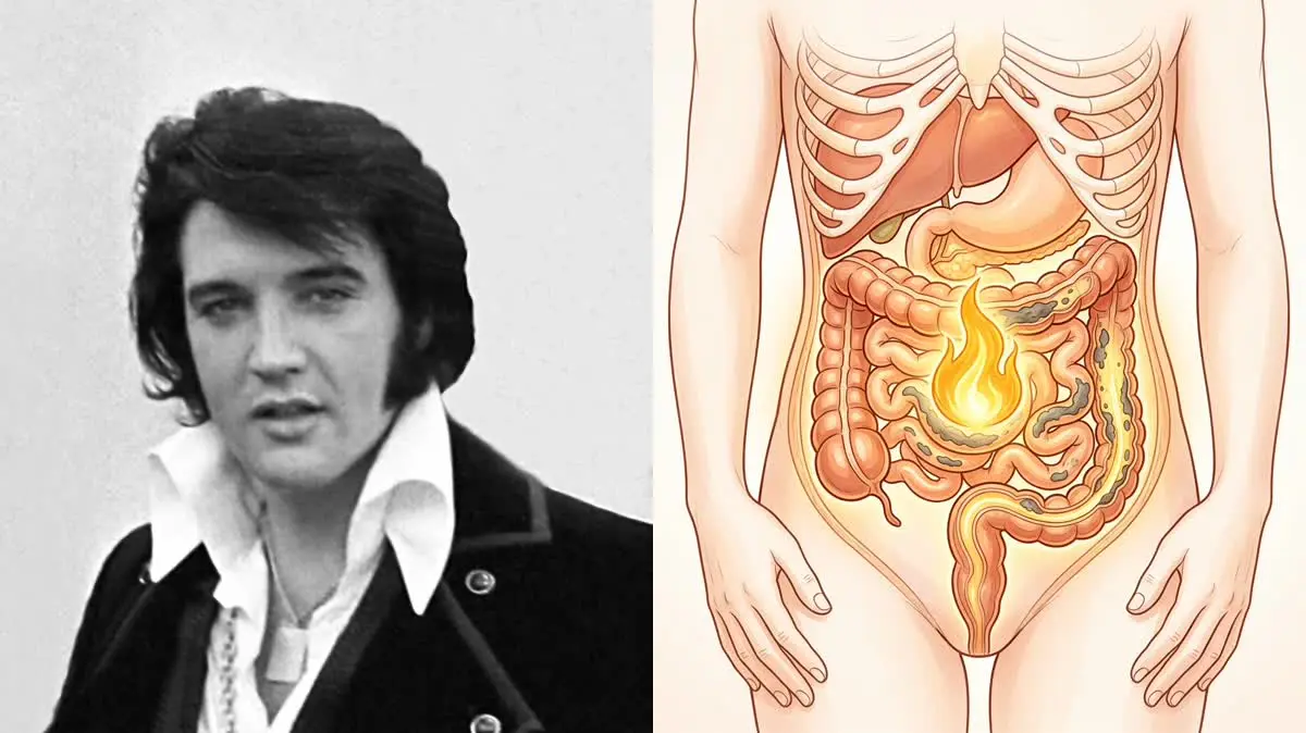 Elvis Presley's Metabolic Collapse: An Ayurvedic Reconstruction
