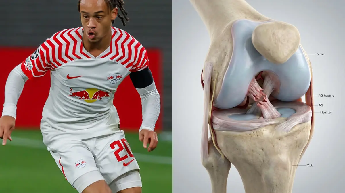 The Biomechanics of Xavi Simons' ACL Rupture: Inside His Road to Recovery After World Cup Heartbreak